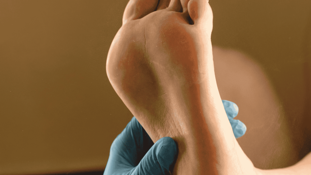 Pé Diabético | Dr. Leonardo Pacheco | Angiologista