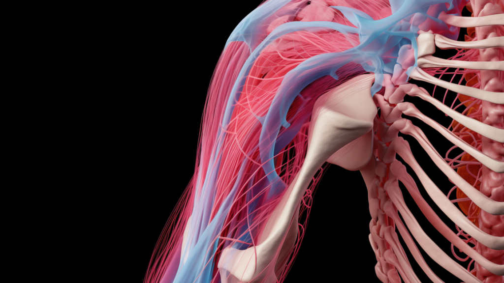 3 Sinais da Síndrome do Desfiladeiro Torácico: Compressão Vascular | Dr. Leonardo Pacheco
