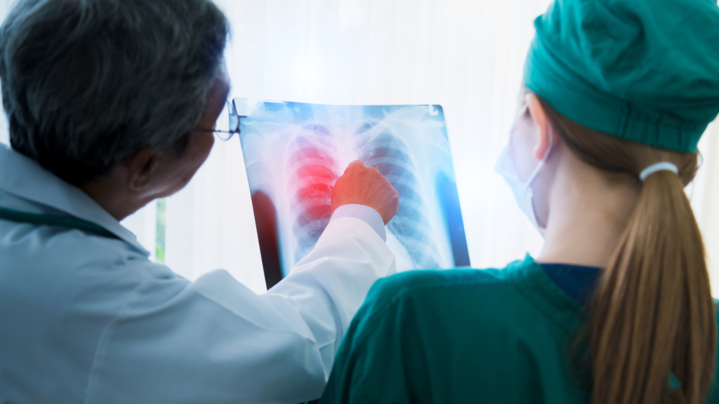 7 Sinais de Tromboembolismo Pulmonar Diagnóstico e Tratamento | Dr. Leonardo Pacheco