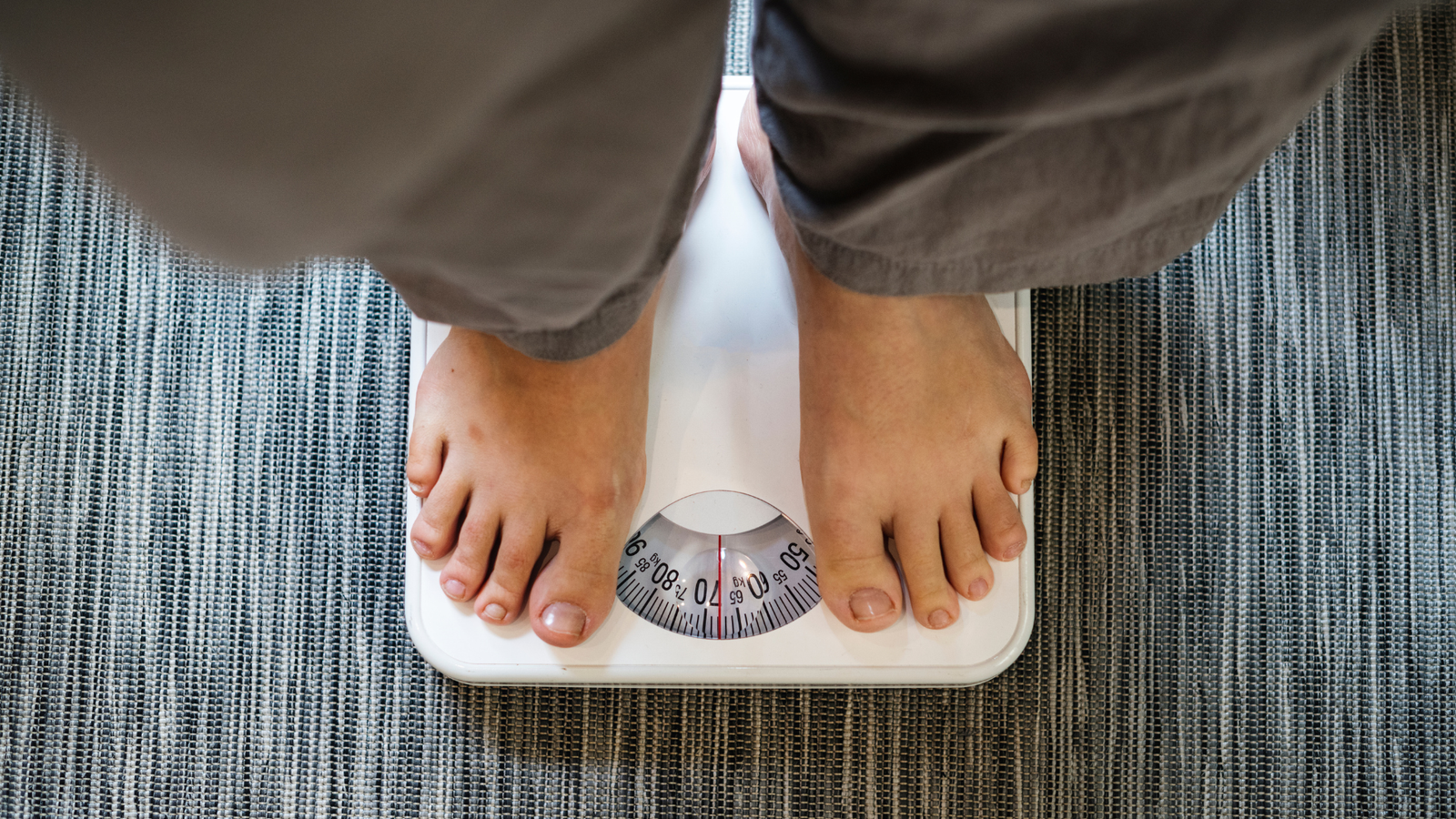 Obesidade e Varizes: Como o Excesso de Peso Impacta a Saúde Venosa | Dr. Leonardo Pacheco